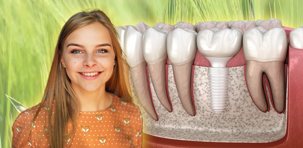 Keramikimplantate