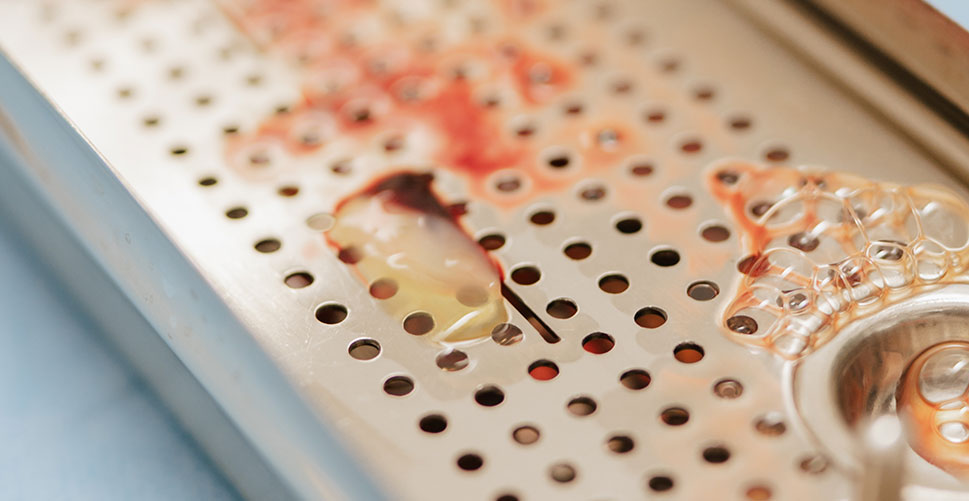 Detailaufnahme Eigenblutmembran