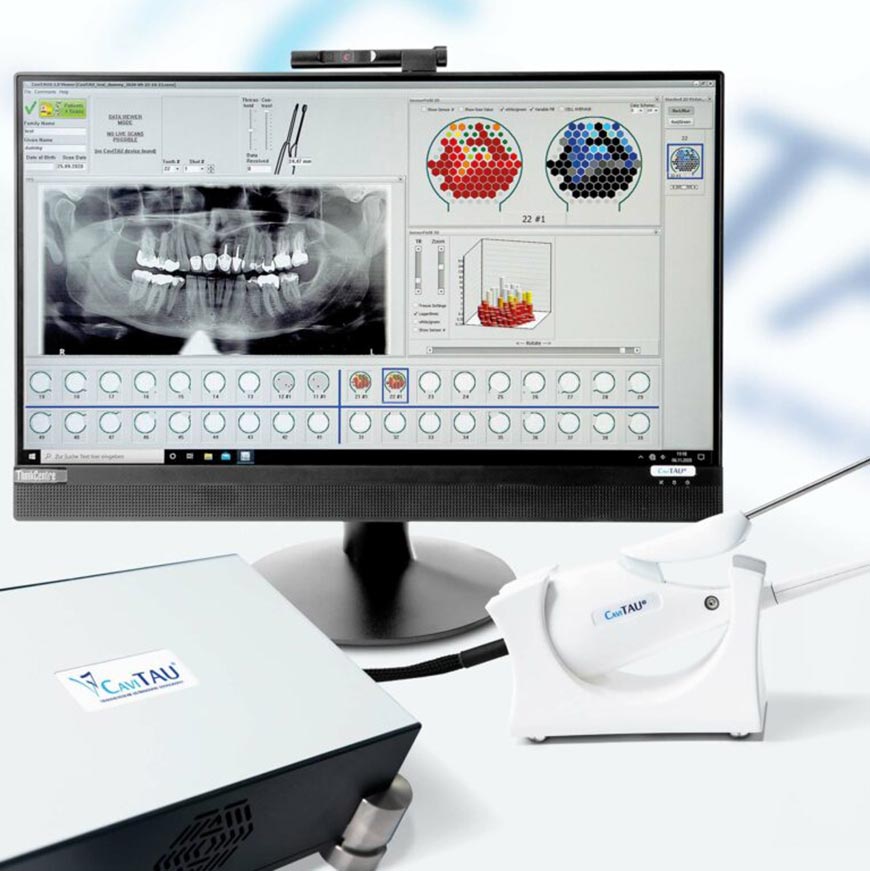 Hier sieht man das Cavitau Gerät und einen Bildschirm mit den Messergebnissen