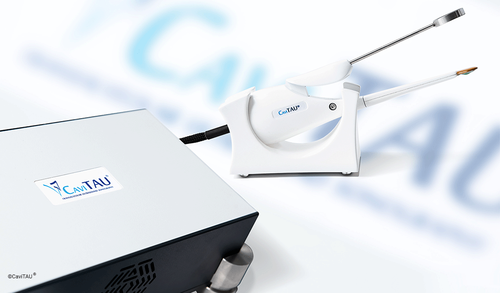 Hier sieht man das CaviTAU Gerät